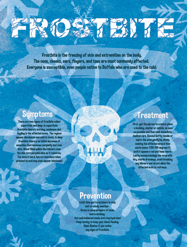 Frostbite Facts and Prevention