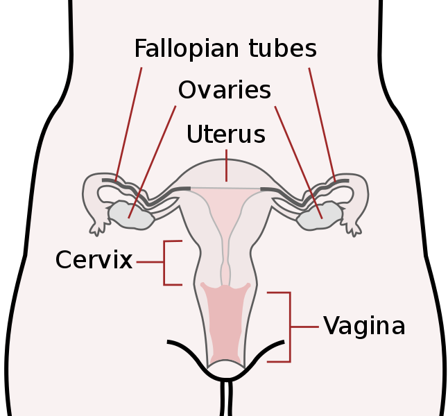 What is Ovarian Cancer