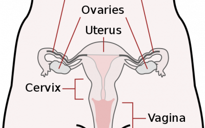 What is Ovarian Cancer