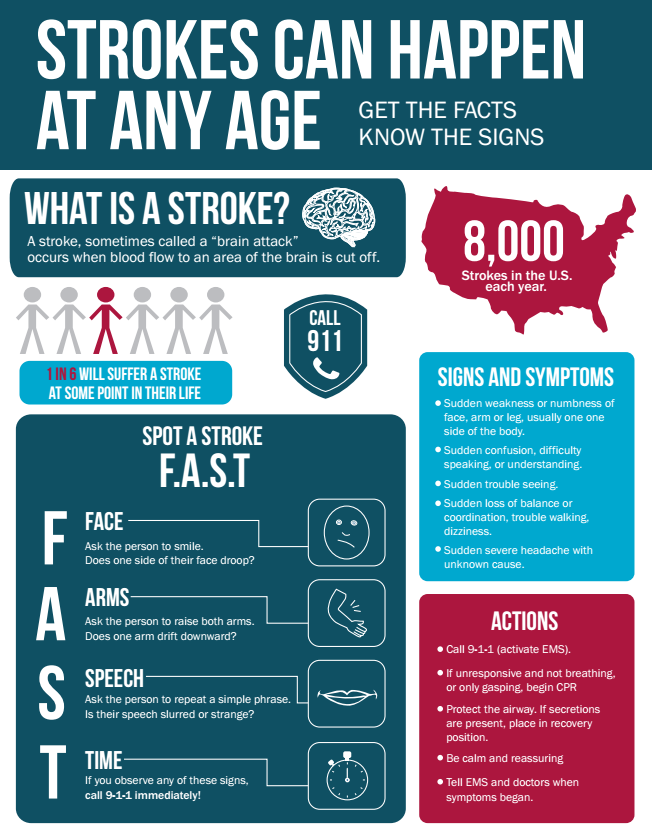 Stroke Statistics