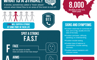 Stroke Statistics