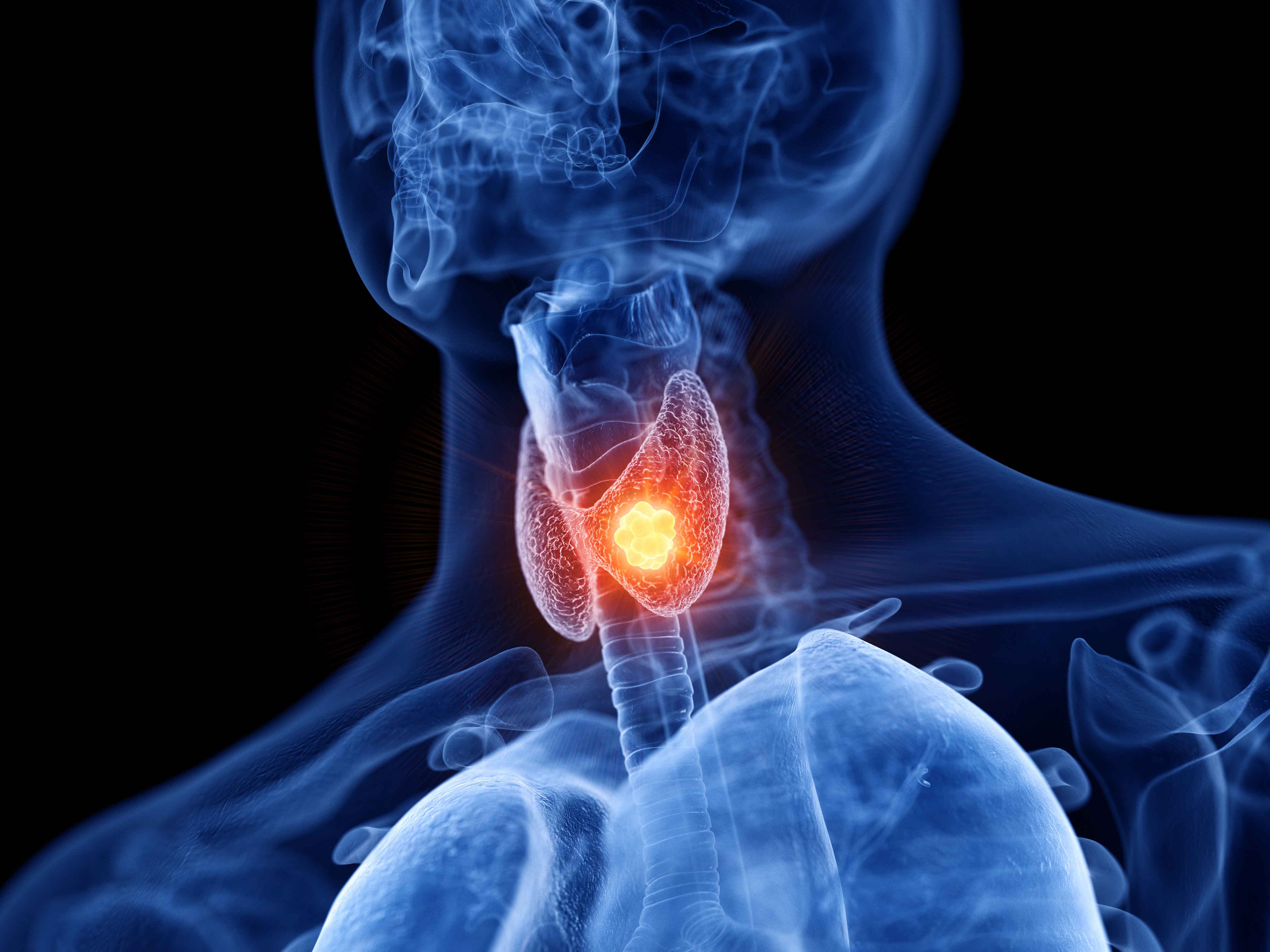 How an Abnormal Thyroid Affects Your Health
