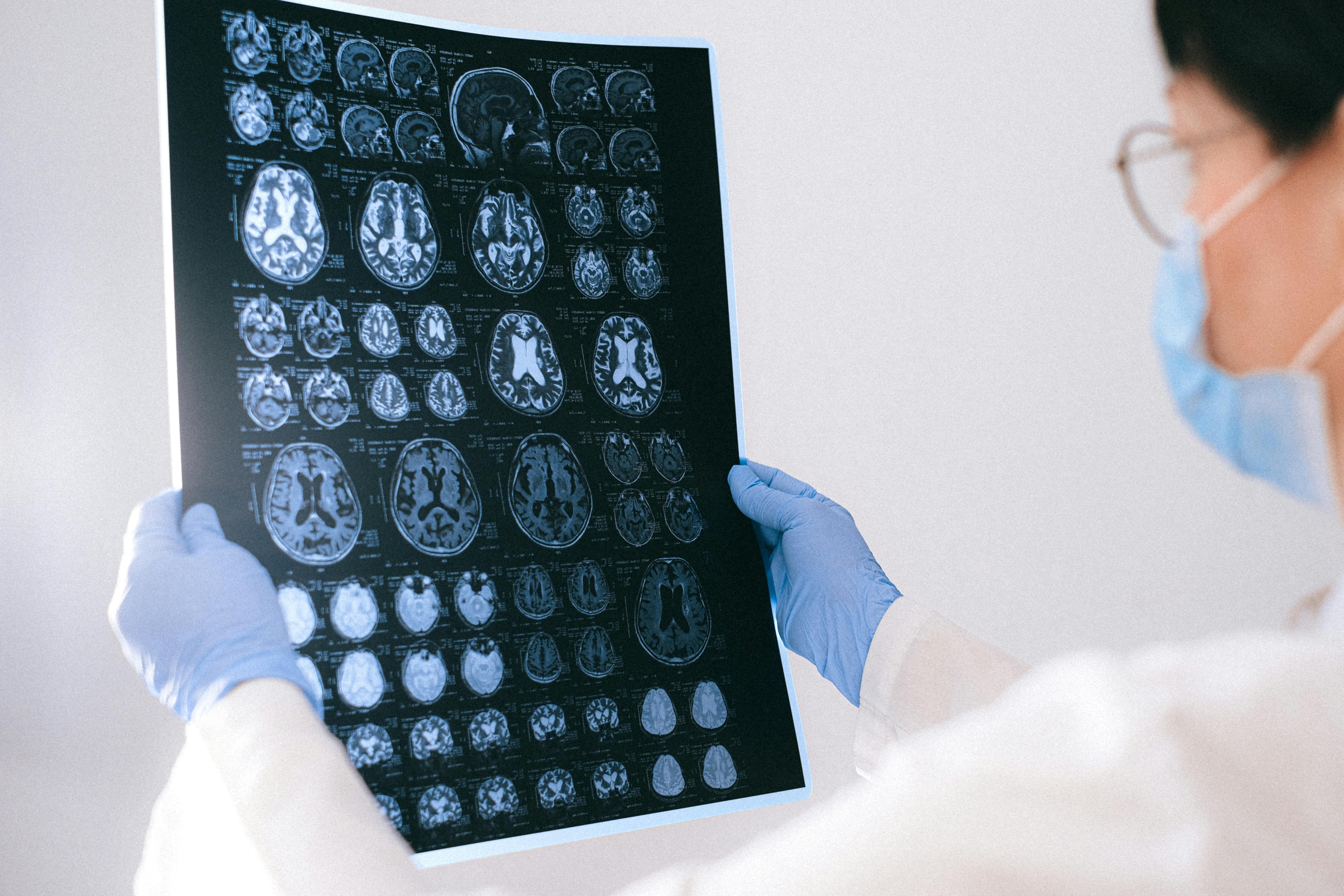 June is Alzheimer’s and Brain Awareness Month