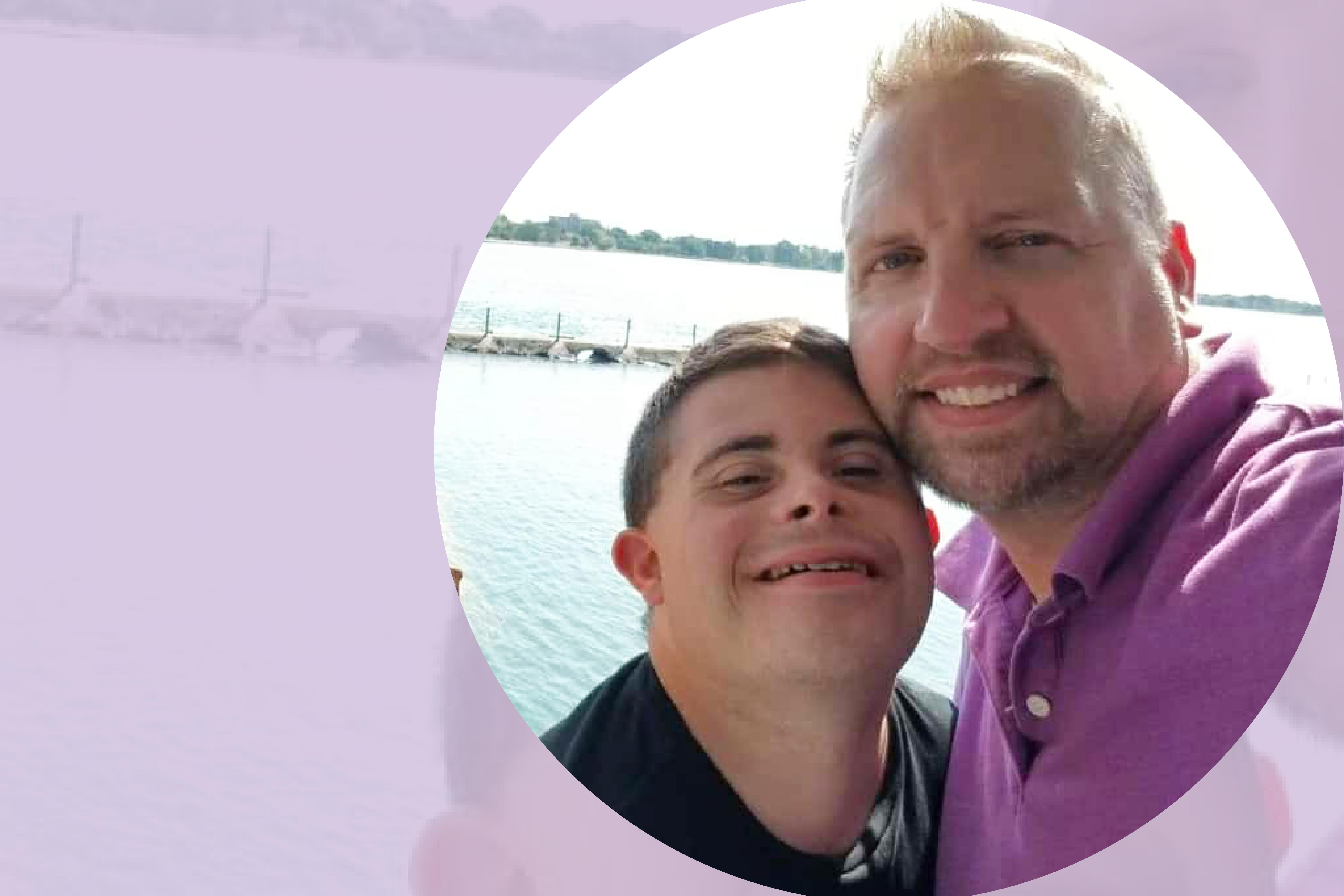 Down’s Syndrome Questions and Answers